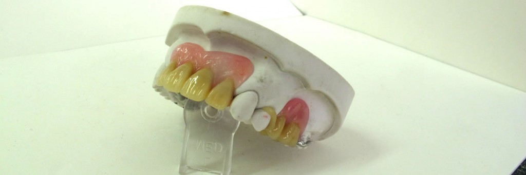 Jaw 
      Registration For Complete Dentures Pensacola FL 32513